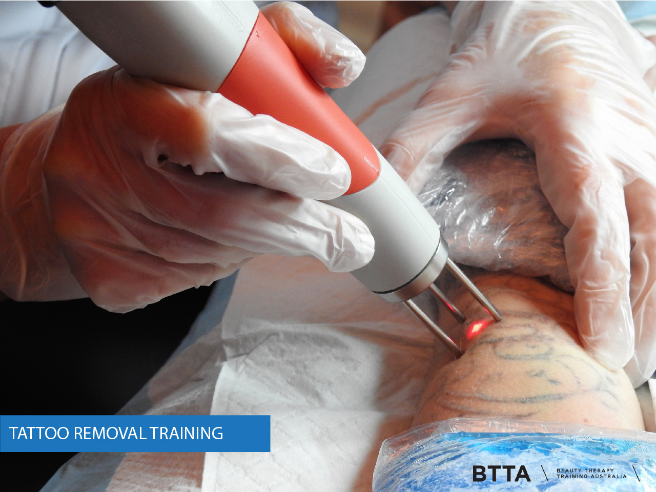 A Laser Academy Tattoo Removal Training  Littleton CO